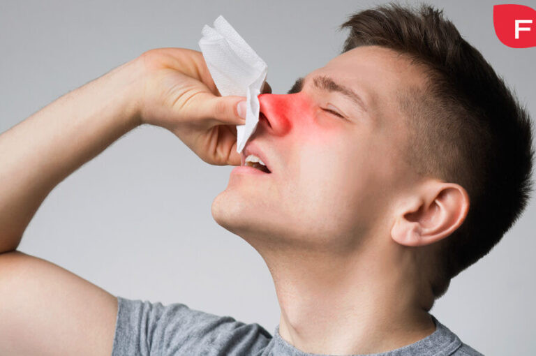 Dolor De Nariz Como Si Me Hubiera Entrado Agua